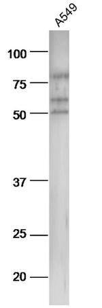 pan-Cytokeratin Antibody in Western Blot (WB)