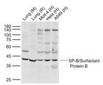 SP-B/Surfactant Protein B Antibody in Western Blot (WB)