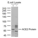 ACE2 Antibody in Western Blot (WB)