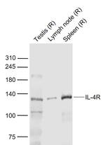 IL-4R Antibody in Western Blot (WB)