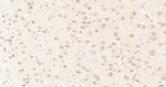 CDKN2A/p16-INK4a Antibody in Immunohistochemistry (Paraffin) (IHC (P))