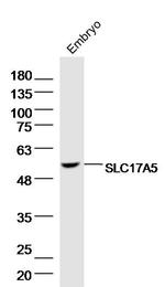 SLC17A5 Antibody in Western Blot (WB)