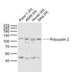 Polycystin 2 Antibody in Western Blot (WB)