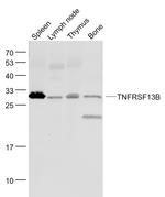 TNFRSF13B Antibody in Western Blot (WB)