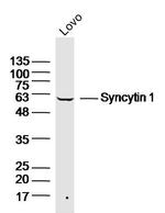 Syncytin 1 Antibody in Western Blot (WB)