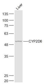 CYP2D6 Antibody in Western Blot (WB)