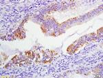 Phospho-FHIT (Tyr114) Antibody in Immunohistochemistry (Paraffin) (IHC (P))