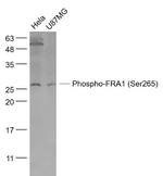 Phospho-FRA1 (Ser265) Antibody in Western Blot (WB)
