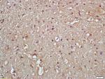 Phospho-IKK gamma (Ser376) Antibody in Immunohistochemistry (Paraffin) (IHC (P))