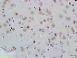 ID1 Antibody in Immunohistochemistry (Paraffin) (IHC (P))