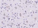 e2 alpha Antibody in Immunohistochemistry (Paraffin) (IHC (P))