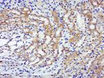 Phospho-p70 S6 Kinase Beta (Thr444, Ser447) Antibody in Immunohistochemistry (Paraffin) (IHC (P))