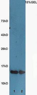 Acetyl-Histone H3 (Lys9) Antibody in Western Blot (WB)