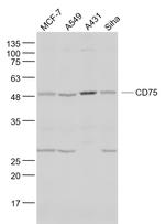 CD75 Antibody in Western Blot (WB)