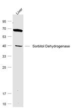 SDH/Sorbitol Dehydrogenase Antibody in Western Blot (WB)