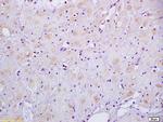 HSD17B1 Antibody in Immunohistochemistry (Paraffin) (IHC (P))