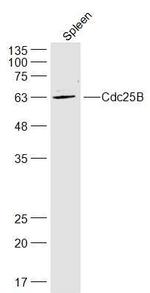 Cdc25B Antibody in Western Blot (WB)