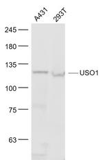 Vesicle docking protein p115 Antibody in Western Blot (WB)