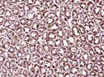 MACC1 Antibody in Immunohistochemistry (Paraffin) (IHC (P))