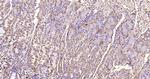 MMP-1 Antibody in Immunohistochemistry (Paraffin) (IHC (P))