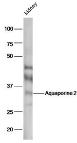 AQP2 Antibody in Western Blot (WB)