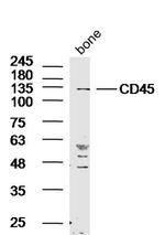 CD45 Antibody in Western Blot (WB)