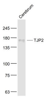 TJP2 Antibody in Western Blot (WB)