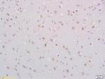 BDNF Antibody in Immunohistochemistry (Paraffin) (IHC (P))