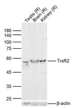 Thioredoxin Reductase 2 Antibody in Western Blot (WB)