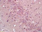 HMGCR Antibody in Immunohistochemistry (Paraffin) (IHC (P))