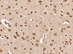 Hsc70 Antibody in Immunohistochemistry (Paraffin) (IHC (P))