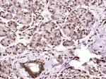 Phospho-CK18 (Ser60) Antibody in Immunohistochemistry (Paraffin) (IHC (P))