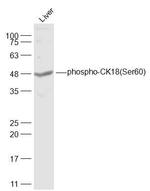 Phospho-CK18 (Ser60) Antibody in Western Blot (WB)