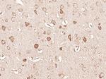 BNIP3L Antibody in Immunohistochemistry (Paraffin) (IHC (P))