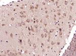 ADORA2B Antibody in Immunohistochemistry (Paraffin) (IHC (P))