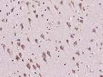 ADORA2B Antibody in Immunohistochemistry (Paraffin) (IHC (P))