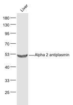 Alpha 2 antiplasmin Antibody in Western Blot (WB)