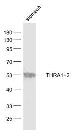 THRA1/2 Antibody in Western Blot (WB)