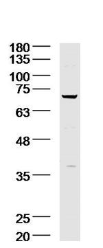 Acid sphingomyelinase Antibody in Western Blot (WB)