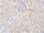 FCAR Antibody in Immunohistochemistry (Paraffin) (IHC (P))