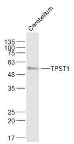 TPST1 Antibody in Western Blot (WB)