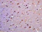 TSSC3 Antibody in Immunohistochemistry (Paraffin) (IHC (P))