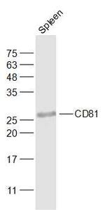 CD81 Antibody in Western Blot (WB)