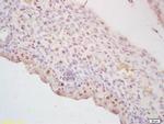 PEBP2B Antibody in Immunohistochemistry (Paraffin) (IHC (P))