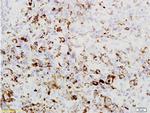 PRAME Antibody in Immunohistochemistry (Paraffin) (IHC (P))