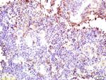 CARD4 Antibody in Immunohistochemistry (Paraffin) (IHC (P))