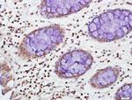 TIA1 Antibody in Immunohistochemistry (Paraffin) (IHC (P))