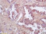 FIS1 Antibody in Immunohistochemistry (Paraffin) (IHC (P))