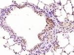 MND1 Antibody in Immunohistochemistry (Paraffin) (IHC (P))