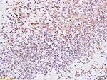 CENPF Antibody in Immunohistochemistry (Paraffin) (IHC (P))